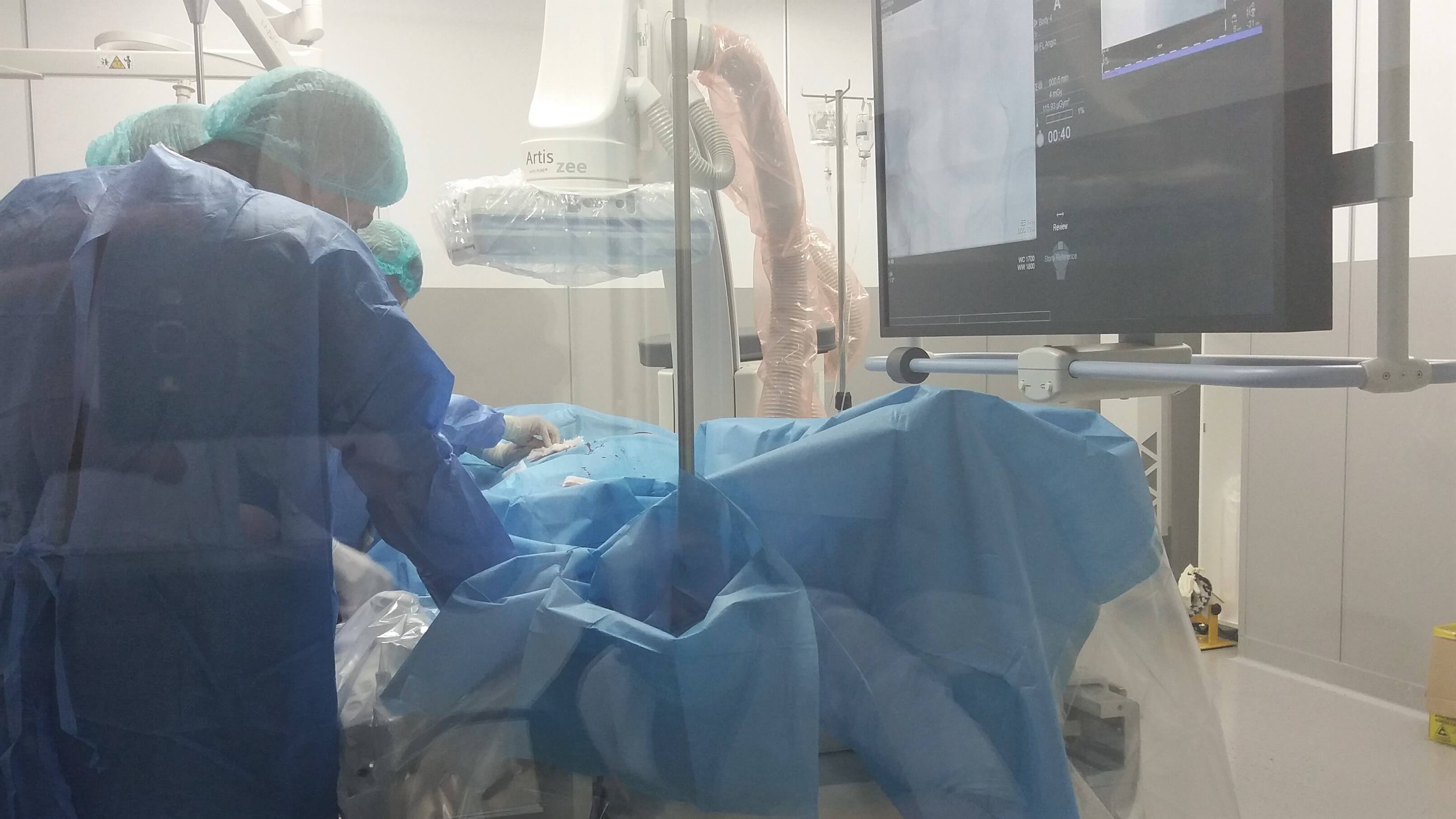 foto chemoembolizare